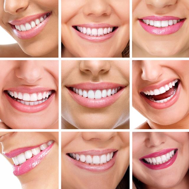 南京牙齿矫正是否会影响脸型？